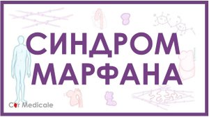 Синдром Марфана - механизм развития, причины, клинические проявления