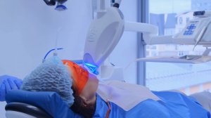 Отбеливание зубов системой ZOOM 4