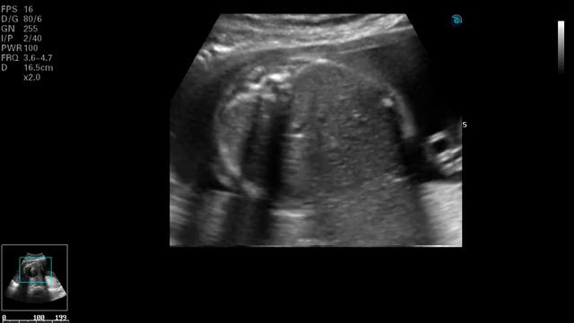 КАПРЛ? смотреть онлайн