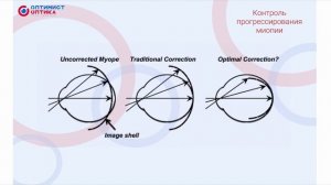 Лекция 6  Детская оптометрия