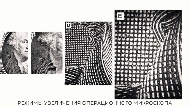 Профессиональная чистка зубов под микроскопом