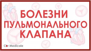Болезни пульмонального клапана: стеноз и регургитация/недостаточность клапана.