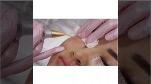 Безоперационная блефаропластика