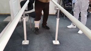Протезування після ампутації по Шопару