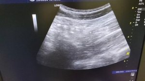 УЗИ желудка и полых органов. Медицинская клиника Ультрамед.