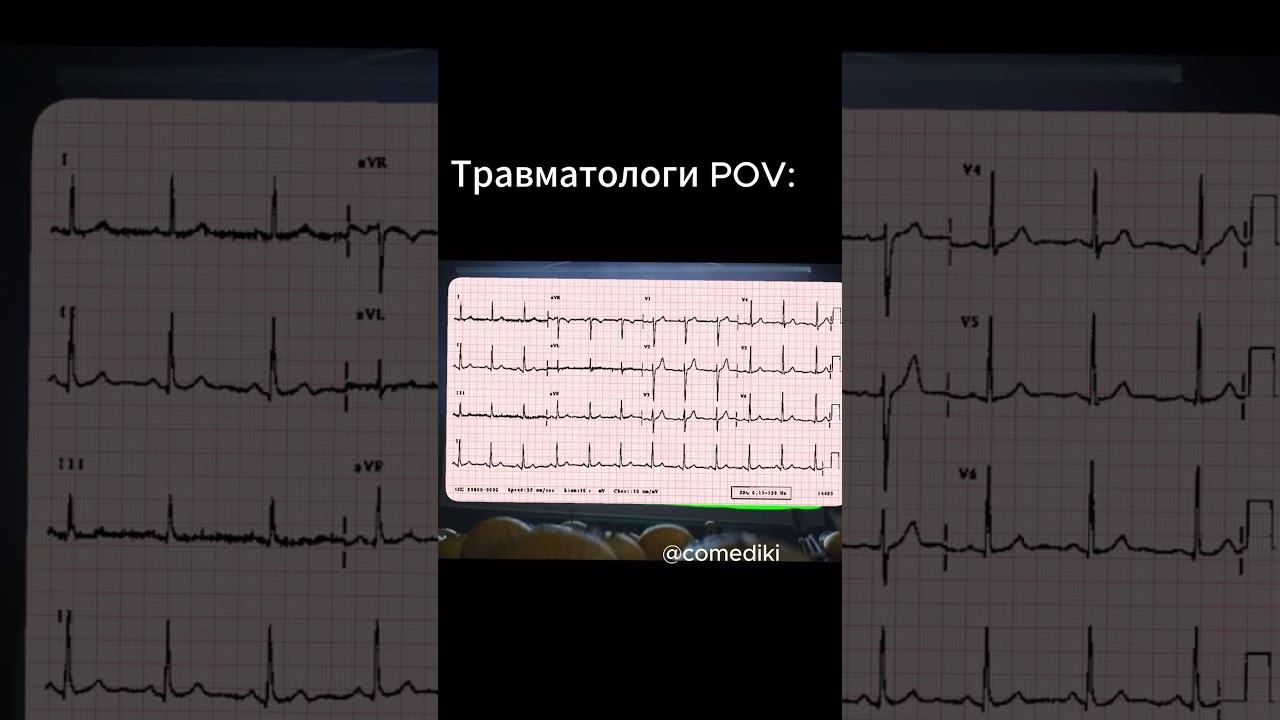 Я травматолога #медицина