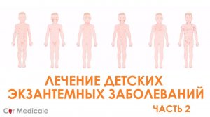Сыпь в педиатрической практике: как лечить детские экзантемы?