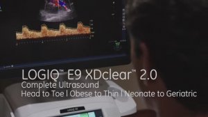 LOGIQ E9 XDclear