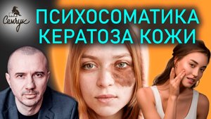 Как кератоз связан со старыми друзьями. Как вернуть коже здоровый вид. Феноменальная психосоматика