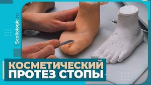 Косметический протез стопы для ребенка