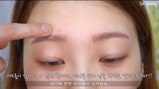 여드름 같이 짜요 (뾰루지 / 피지 / 블랙헤드 압출하는법 / 짜는법)┃소정 Sojeong