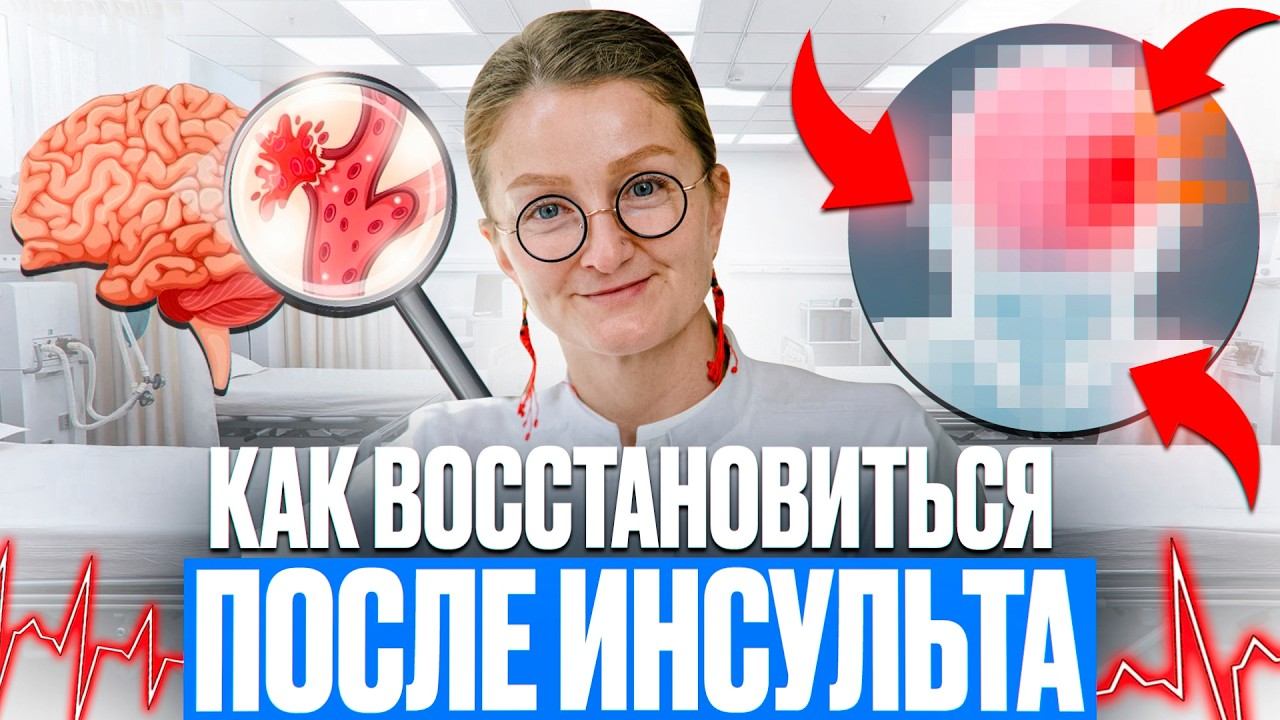Реабилитация после инсульта: как вернуться к жизни? // 5 принципов восстановления после инсульта смотреть онлайн