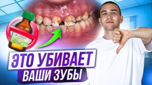 Вы чистите зубы НЕ ПРАВИЛЬНО! Топ 5 ошибок гигиены полости рта