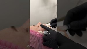 Препарат, который покорил меня, моих коллег и пациентов. L (+) Lift - истинный коллагеностимулятор!