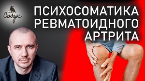 Как снять блокировку своих суставов при ревматоидном артрите. Феноменальная психосоматика