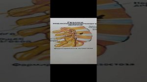 Грыжа межпозвоночного диска