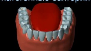 Кариес и причины его возникновения