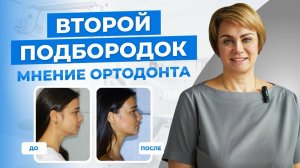 Второй подбородок: мнение ортодонта