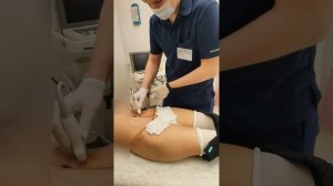 Осмотр пациентки после абдоминопластики