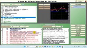 2024-07-24_140536-ПО Дианел®-2.1. обучение работе, Эталоны-AL-Микроэлементы