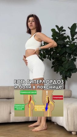 Есть гиперлордоз и боли в пояснице?