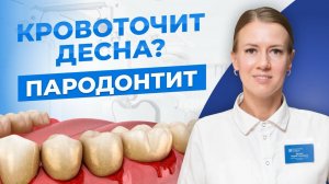 Самая коварная болезнь зубов и дёсен — пародонтит!
