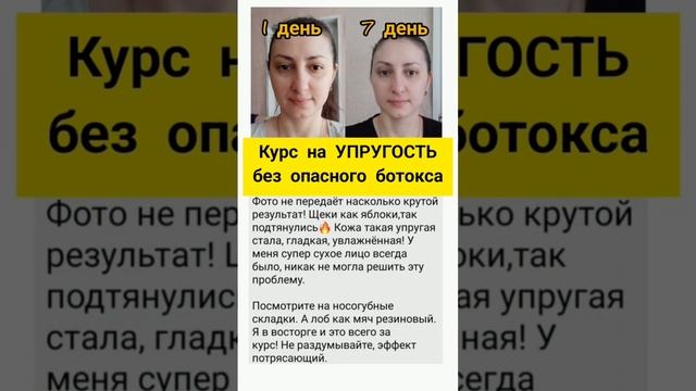 #ботокс #безморщин #безпластики #ботоксненужен #безуколовкрасоты
