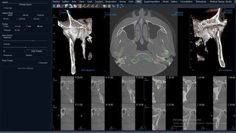 Анатолий консультация