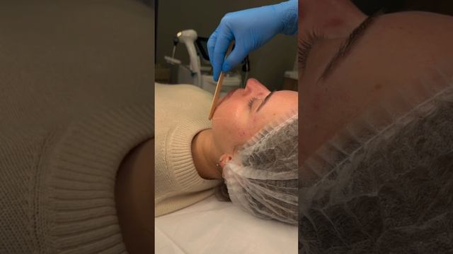 Капсула VITAL DOME + Фотоомоложение