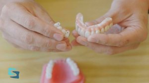 Why All-on-4 Teeth Are Impossible to Keep Clean!