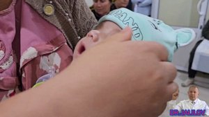 МИКРОЦЕФАЛИЯ У ДЕТЕЙ МАЛОГО ВОЗРАСТА //РЕЗУЛЬТАТ ЗА 9 ДНЕЙ