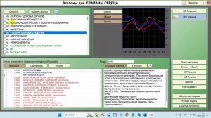 2024-07-24_131619-Обучение ПО Дианел®-2.1. работа с Эталонами группы -AF-Лекарственные средства