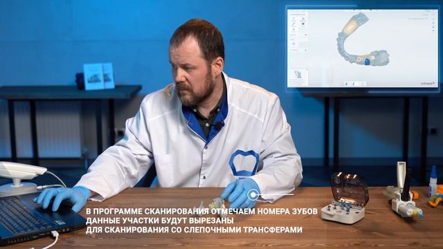 Цифровое сканирование челюсти для получения 3D оттиска с доктором Соболевым Д.А.