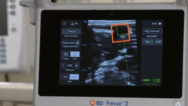 BD Cue™ Needle Tracking System with BD Prevue™ II Vascular Access System смотреть онлайн