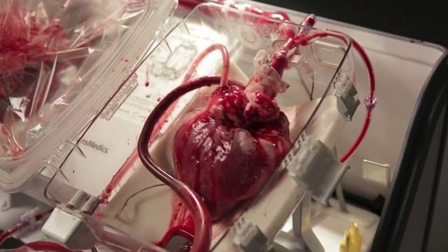Fascinating video of a donors heart being kept beating. смотреть онлайн