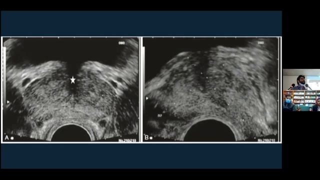 Diagnosis of Prostate Cancer смотреть онлайн
