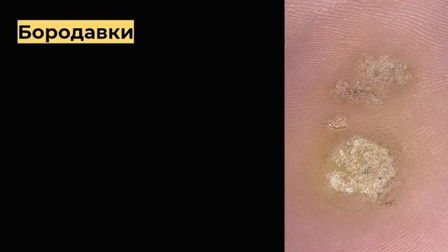 инфекционные заболевания кожи смотреть онлайн