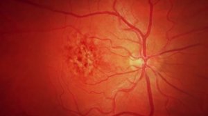 Слепота и слабовидение