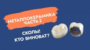Сколы металлокерамических протезов. В чем причина?