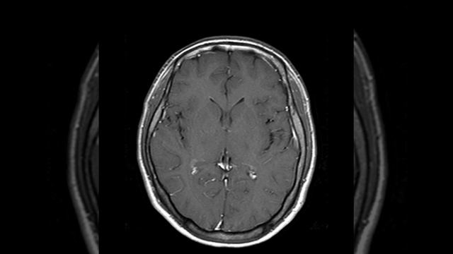 CNS C9 DNET (C)