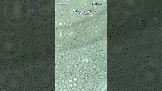 Menthol vs Germs Under Microscope смотреть онлайн
