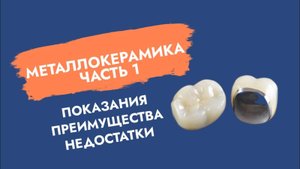 Металлокерамика. Что должен знать пациент?
