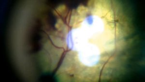 Артериальная гипертензия кошек.