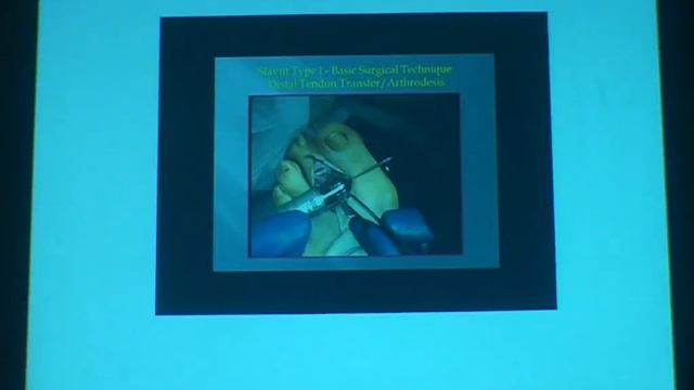 Lesser toes pathologies , Tendinopathies around ankle D.Amr Farouk смотреть онлайн