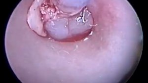 Удаление ушного полипа у кошки.  Ear polyp removal in a cat.