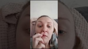 Герпес на губах и носу