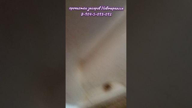 Мочевой камень. Знакомьтесь.