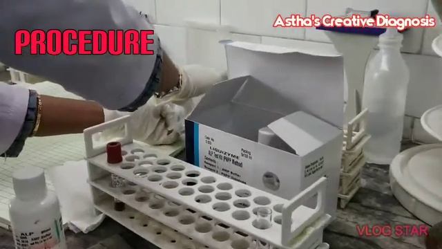 DMLT Online Class || Alkaline phosphatase Blood Test in ERBA Chem 5