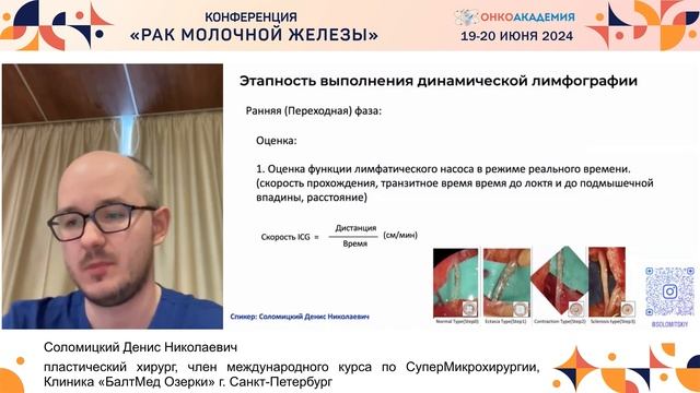 Современные возможности в ICG диагностике лимфедемы верхней конечности. Соломицкий Д.Н. смотреть онлайн