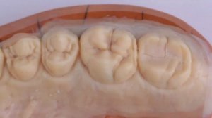 Инструкция от бренда DENTIN.UZ